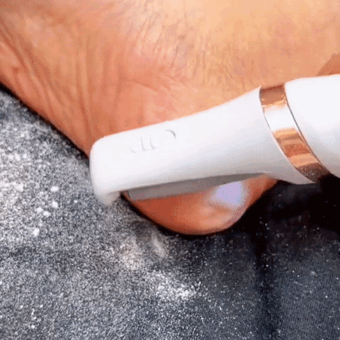 👣 ¡Decile adiós a los callos y durezas! Removedor Eléctrico para Pies Suaves y Perfectos