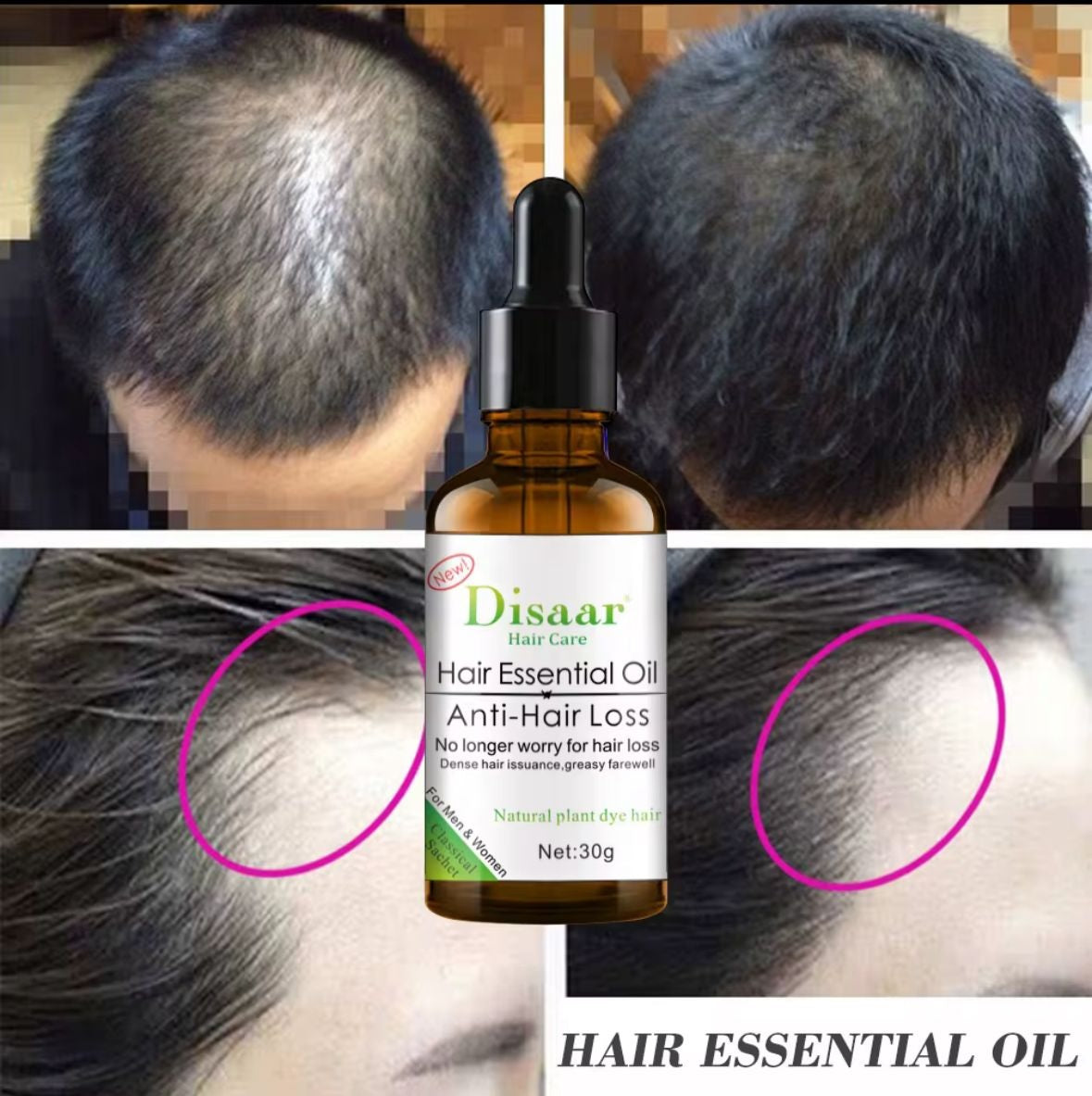 ✨🧴 Aceite Capilar Premium – Más fuerza, más crecimiento, más salud🌿💪