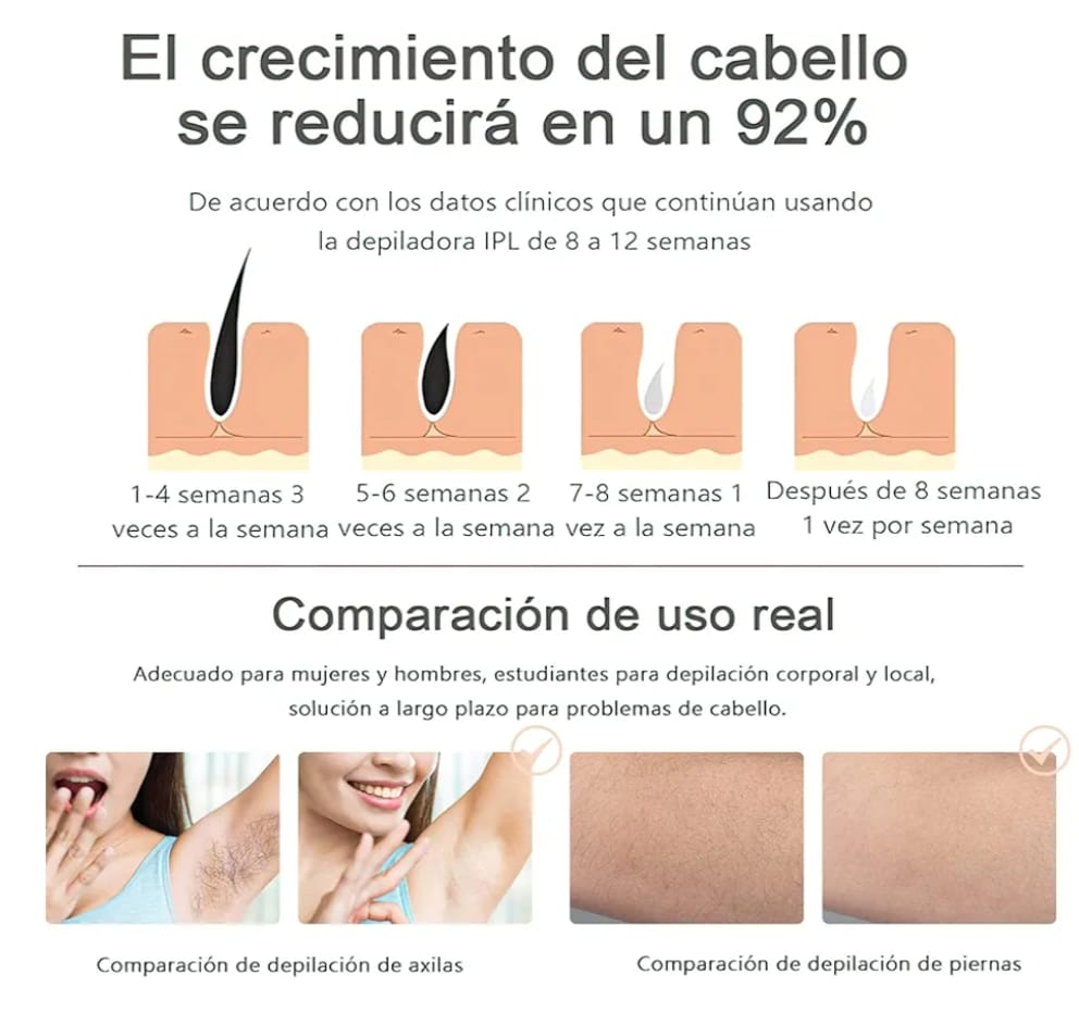 ✨🛡️ ¡Depilación sin dolor y desde casa! Depiladora Láser IPL – Tecnología profesional para una piel suave y libre de vello 💖🦵